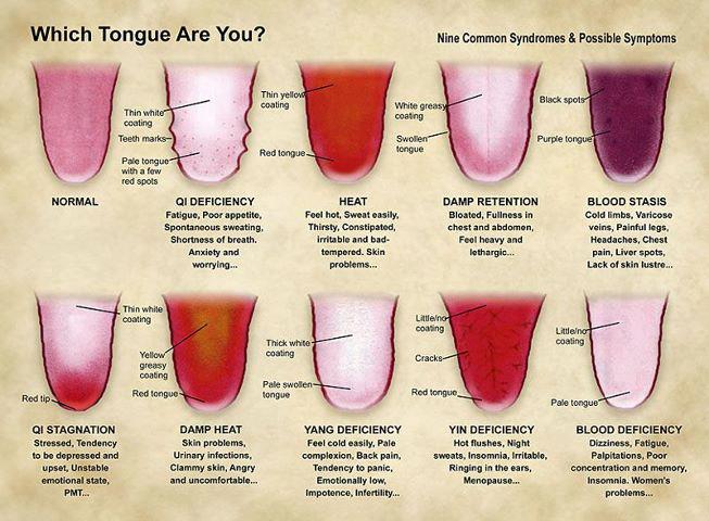 tongue.jpg